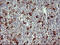 Matrix Metallopeptidase 13 antibody, LS-C788271, Lifespan Biosciences, Immunohistochemistry frozen image 