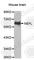 Neurofilament Light antibody, A0522, ABclonal Technology, Western Blot image 