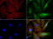 Sequestosome 1 antibody, LS-C796673, Lifespan Biosciences, Immunofluorescence image 