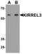 Kirre Like Nephrin Family Adhesion Molecule 3 antibody, MBS153422, MyBioSource, Western Blot image 
