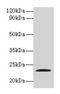 Junctional Adhesion Molecule 2 antibody, LS-C285545, Lifespan Biosciences, Western Blot image 