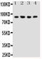 Neuregulin 2 antibody, PA1637, Boster Biological Technology, Western Blot image 