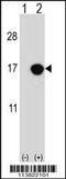 Cyclin-dependent kinase 4 inhibitor B antibody, 56-550, ProSci, Western Blot image 