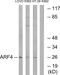 ADP Ribosylation Factor 4 antibody, PA5-39010, Invitrogen Antibodies, Western Blot image 