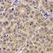 Hepatocyte Growth Factor-Regulated Tyrosine Kinase Substrate antibody, orb339091, Biorbyt, Immunohistochemistry paraffin image 