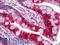 Galectin 3 antibody, LS-B10995, Lifespan Biosciences, Immunohistochemistry paraffin image 