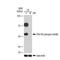 Protein Kinase CAMP-Dependent Type II Regulatory Subunit Alpha antibody, GTX03216, GeneTex, Western Blot image 