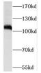 Putative ribosomal RNA methyltransferase NOP2 antibody, FNab05794, FineTest, Western Blot image 