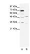 Cholinergic Receptor Nicotinic Gamma Subunit antibody, PA1-24273, Invitrogen Antibodies, Western Blot image 