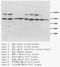 Neurotrophic Receptor Tyrosine Kinase 1 antibody, LS-C172119, Lifespan Biosciences, Western Blot image 