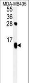ATP Synthase F1 Subunit Delta antibody, LS-C156656, Lifespan Biosciences, Western Blot image 