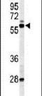 Nuclear Receptor Subfamily 1 Group H Member 3 antibody, PA5-26951, Invitrogen Antibodies, Western Blot image 