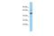 Acyl-CoA Oxidase Like antibody, A12751, Boster Biological Technology, Western Blot image 