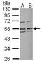 Ribosomal RNA Processing 1 antibody, PA5-30279, Invitrogen Antibodies, Western Blot image 