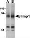 PR/SET Domain 1 antibody, 3991, ProSci, Western Blot image 