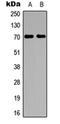 Ribosomal Protein S6 Kinase B1 antibody, orb304571, Biorbyt, Western Blot image 
