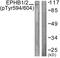 EPH Receptor B1 antibody, PA5-38480, Invitrogen Antibodies, Western Blot image 