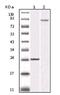 Inhibitor Of Nuclear Factor Kappa B Kinase Subunit Beta antibody, AM06154SU-N, Origene, Western Blot image 