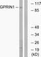 G Protein Regulated Inducer Of Neurite Outgrowth 1 antibody, GTX87160, GeneTex, Western Blot image 