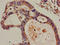 DIS3 Homolog, Exosome Endoribonuclease And 3'-5' Exoribonuclease antibody, LS-C675100, Lifespan Biosciences, Immunohistochemistry paraffin image 