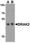 Serine/Threonine Kinase 17b antibody, NBP1-76885, Novus Biologicals, Western Blot image 