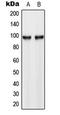 Hexokinase 3 antibody, LS-C354000, Lifespan Biosciences, Western Blot image 