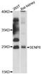 SUMO Peptidase Family Member, NEDD8 Specific antibody, LS-C747832, Lifespan Biosciences, Western Blot image 