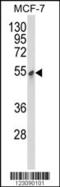 Pyruvate Dehydrogenase Kinase 3 antibody, 62-611, ProSci, Western Blot image 