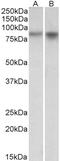 NADPH Oxidase 5 antibody, 42-714, ProSci, Western Blot image 