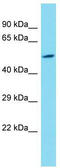 Lysine Demethylase 4E antibody, TA337374, Origene, Western Blot image 