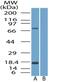 Solute Carrier Family 28 Member 3 antibody, NBP2-29615, Novus Biologicals, Western Blot image 