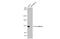 Cadherin 1 antibody, GTX629691, GeneTex, Western Blot image 