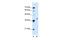 Homeobox D11 antibody, GTX48946, GeneTex, Western Blot image 