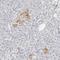 Protein kinase domain-containing protein, cytoplasmic antibody, NBP1-80756, Novus Biologicals, Immunohistochemistry frozen image 