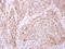 Ethanolamine kinase 1 antibody, GTX105887, GeneTex, Immunohistochemistry paraffin image 