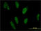 Peroxisome Proliferator Activated Receptor Alpha antibody, LS-C197958, Lifespan Biosciences, Immunofluorescence image 