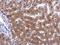 Nicotinamide Phosphoribosyltransferase antibody, GTX128980, GeneTex, Immunohistochemistry paraffin image 