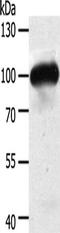 Mitogen-Activated Protein Kinase Kinase Kinase Kinase 3 antibody, CSB-PA082361, Cusabio, Western Blot image 