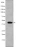 Eukaryotic Translation Initiation Factor 2 Subunit Beta antibody, abx215111, Abbexa, Western Blot image 