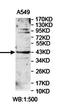 Lysophosphatidylglycerol Acyltransferase 1 antibody, orb78444, Biorbyt, Western Blot image 