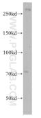 NIPBL Cohesin Loading Factor antibody, 18792-1-AP, Proteintech Group, Western Blot image 