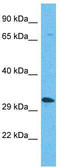 Olfactory Receptor Family 5 Subfamily AP Member 2 antibody, TA337516, Origene, Western Blot image 