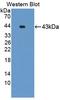 Gastrin Releasing Peptide Receptor antibody, LS-C702563, Lifespan Biosciences, Western Blot image 