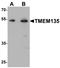 Transmembrane Protein 135 antibody, LS-B10095, Lifespan Biosciences, Western Blot image 