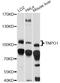 Transportin-1 antibody, LS-C749030, Lifespan Biosciences, Western Blot image 