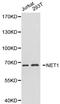 Neuroepithelial Cell Transforming 1 antibody, LS-C192475, Lifespan Biosciences, Western Blot image 