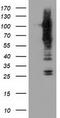 Transforming Acidic Coiled-Coil Containing Protein 3 antibody, TA501264, Origene, Western Blot image 