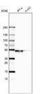 WSC Domain Containing 2 antibody, NBP1-93622, Novus Biologicals, Western Blot image 