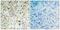 RB Transcriptional Corepressor 1 antibody, PA5-37716, Invitrogen Antibodies, Immunohistochemistry paraffin image 