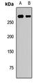 Chromodomain Helicase DNA Binding Protein 3 antibody, LS-C668130, Lifespan Biosciences, Western Blot image 
